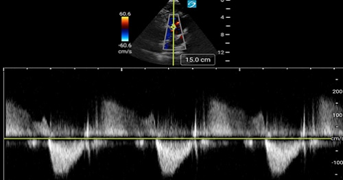 Doppler Principles