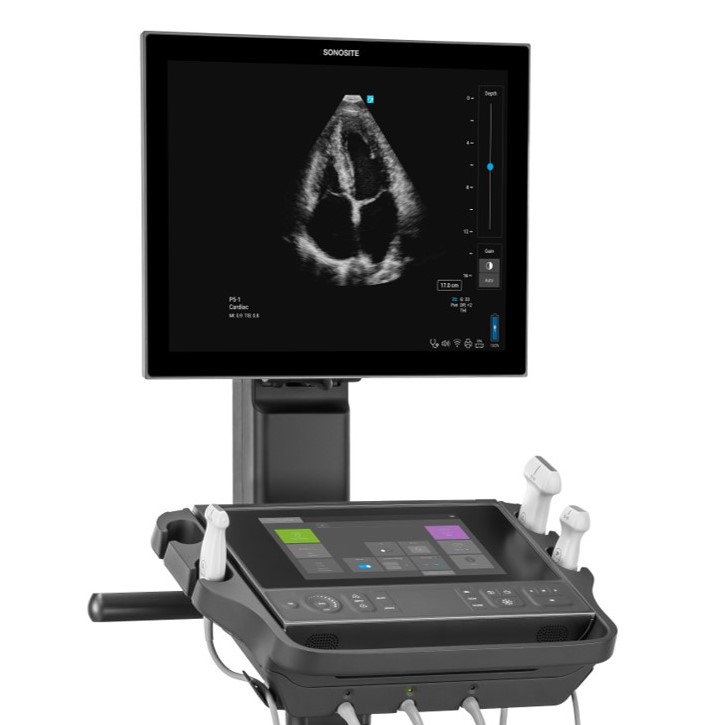 Sonosite LX Image